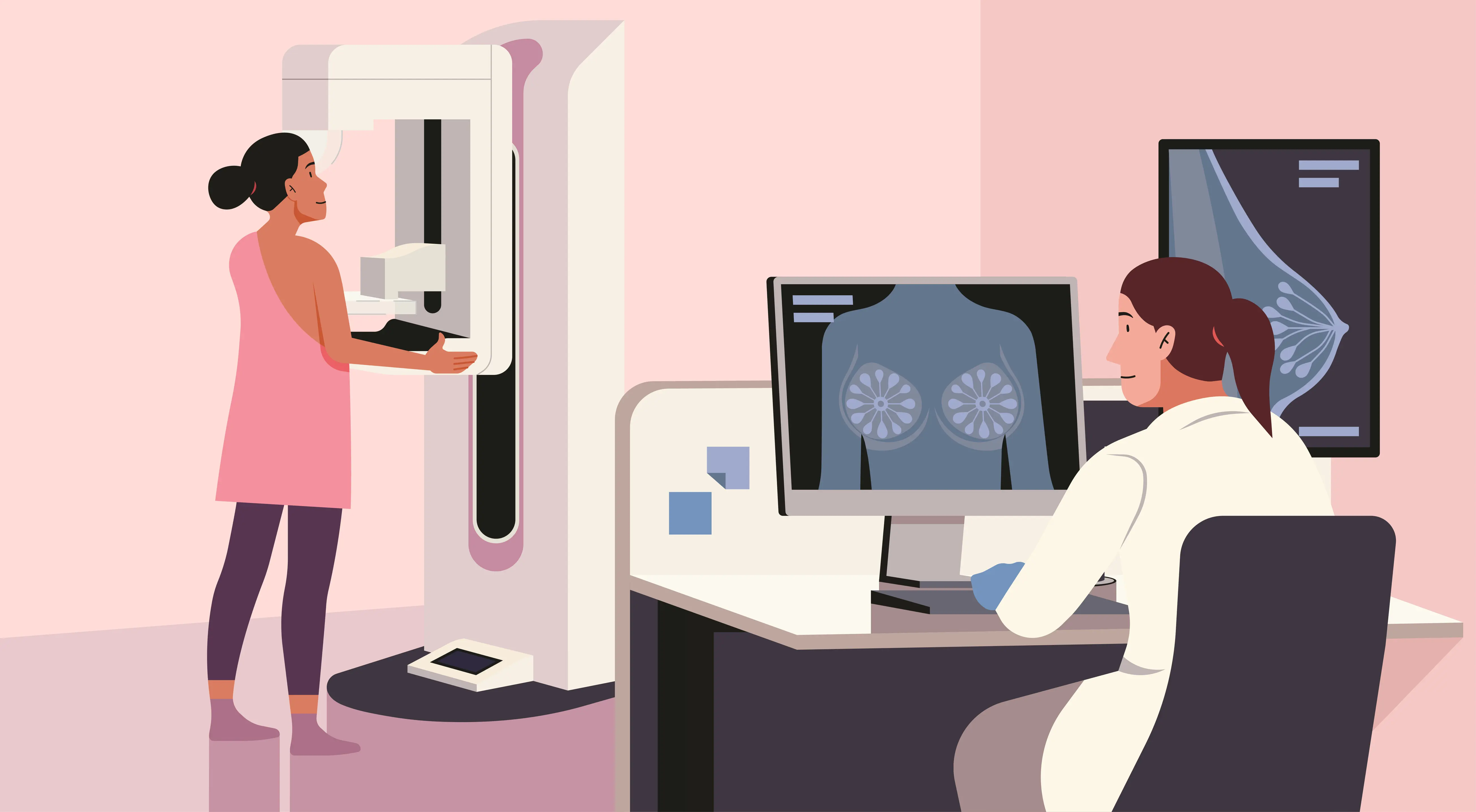 Illustration of a mammogram