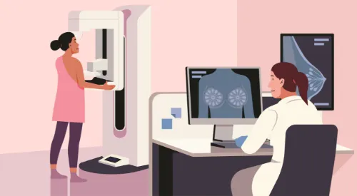 Illustration of a mammogram. ST.art - stock.adobe.com Illustration of a mammogram