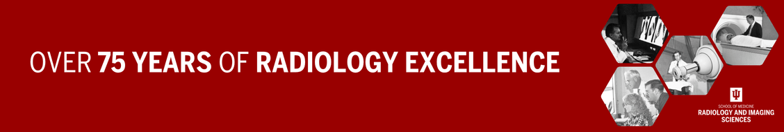 A banner on a red background. On the left, in white text, it reads "OVER 75 YEARS OF RADIOLOGY EXCELLENCE". On the right, there are five hexagonal images in black and white, showcasing the evolution of radiology: Top left: A person looking at a medical image on a light board. Top right: A person lying on a bed entering an MRI machine. Middle right: An empty MRI machine. Bottom right: A person getting an X-ray of their arm. Bottom left: Two people looking at a film. Below the hexagonal images is the Indiana University (IU) logo, with "INDIANA UNIVERSITY SCHOOL OF MEDICINE" and "RADIOLOGY AND IMAGING SCIENCES" written beneath it.