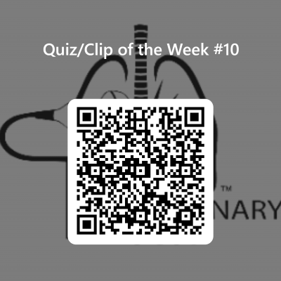 QRCode for Quiz_Clip of Week #10