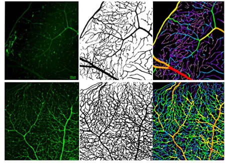 retina image comparison