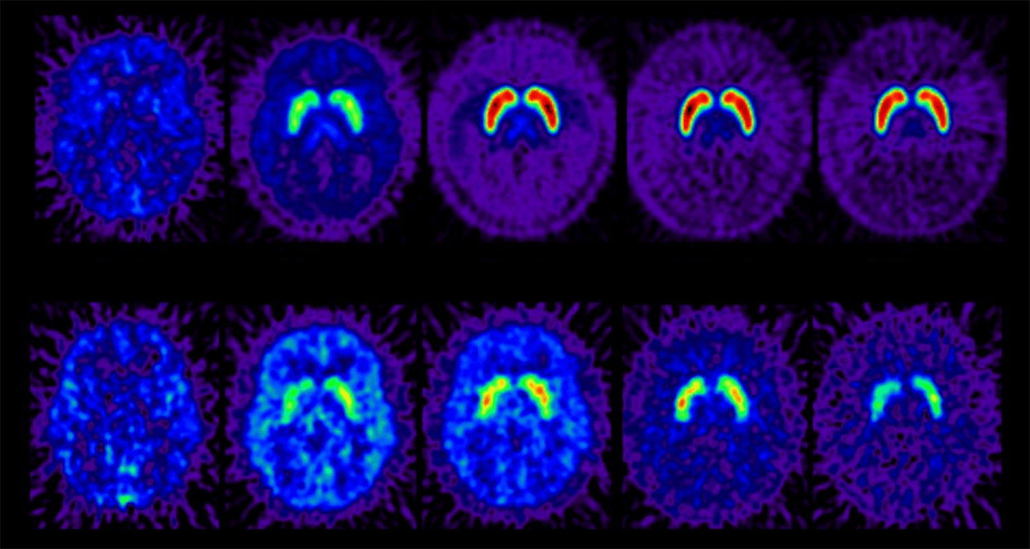 Ten neuroimaging scans of the brain in blue hues.