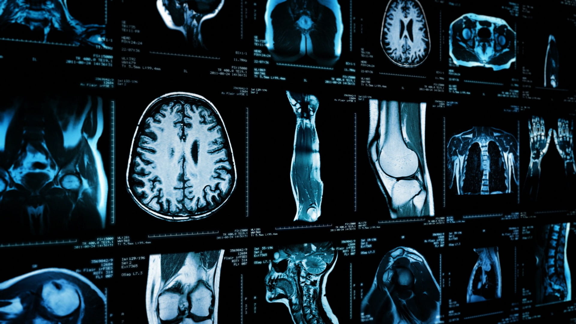 Image of a variety of different scans: skull, chest, arm, knee, etc.