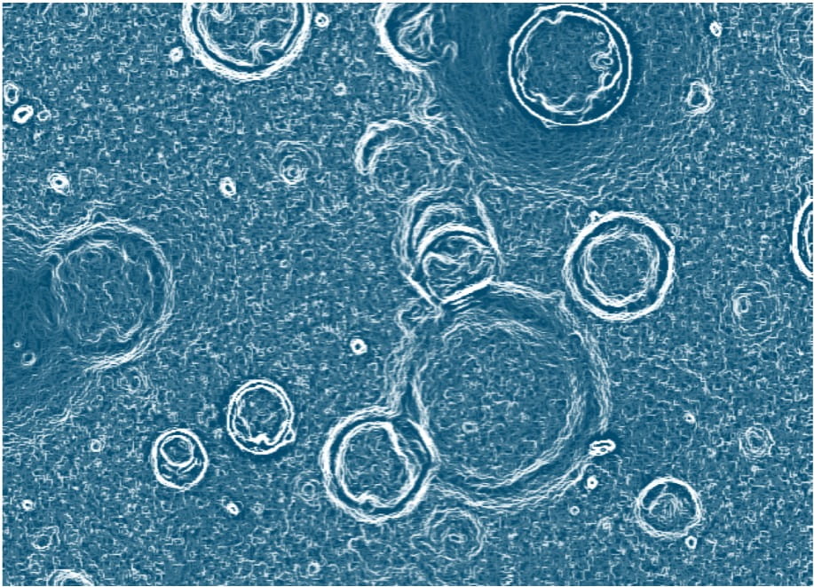 liver organoids