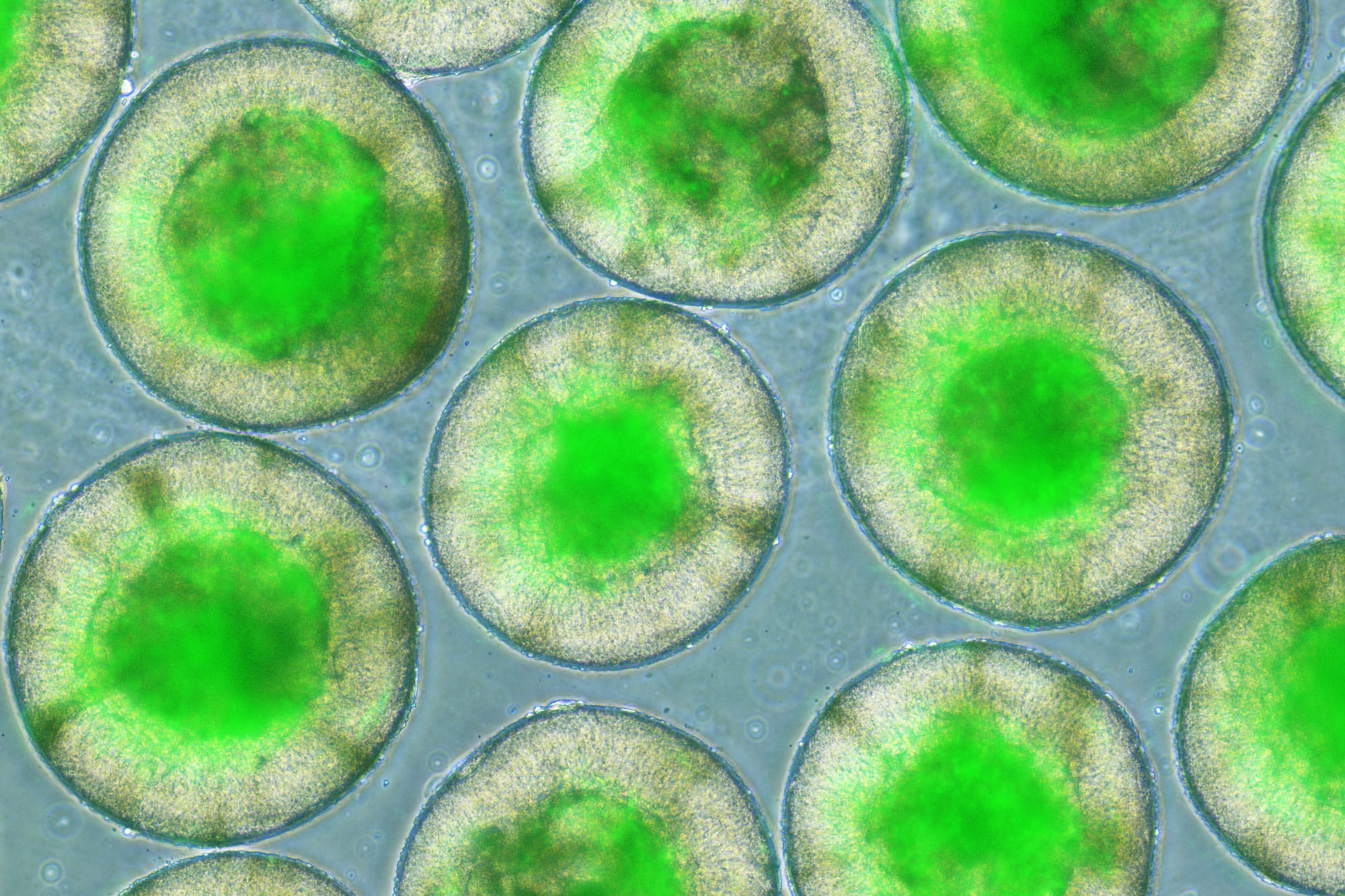 a microscopic look at retinal organoids