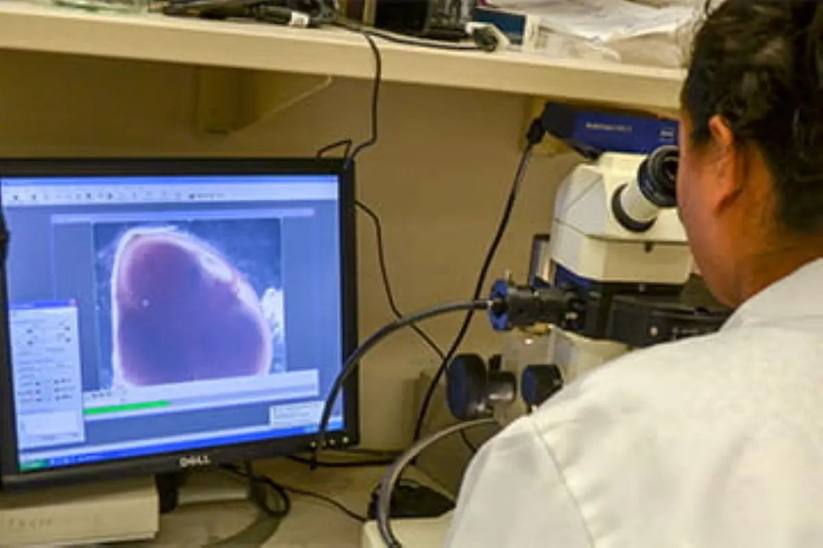 Lab technician view image on computer screen