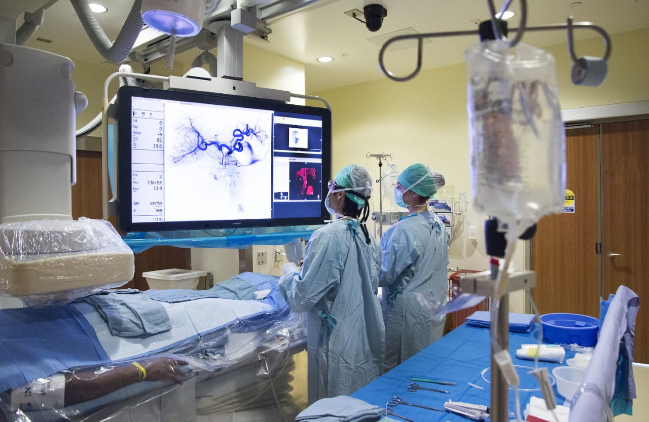 Two medical professionals, dressed in light blue surgical gowns, masks, and caps, stand facing a large monitor displaying medical images, including what appears to be an angiogram of brain vessels. They are positioned at the head of a patient who is covered by blue drapes on a gurney to the left. Overhead, a large medical imaging arm extends over the patient. In the foreground on the right, an IV bag hangs from a stand, and a surgical tray covered with a blue cloth holds various instruments. The room is brightly lit, typical of an operating or interventional suite.