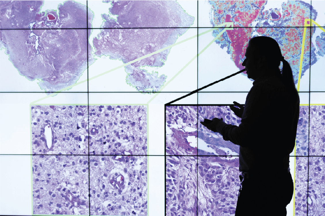 Spyridon Bakas is silhouetted by a digital screen taking up the full wall. The screen is displaying pathology slides used to augment the diagnostic capabilities of physicians with AI.