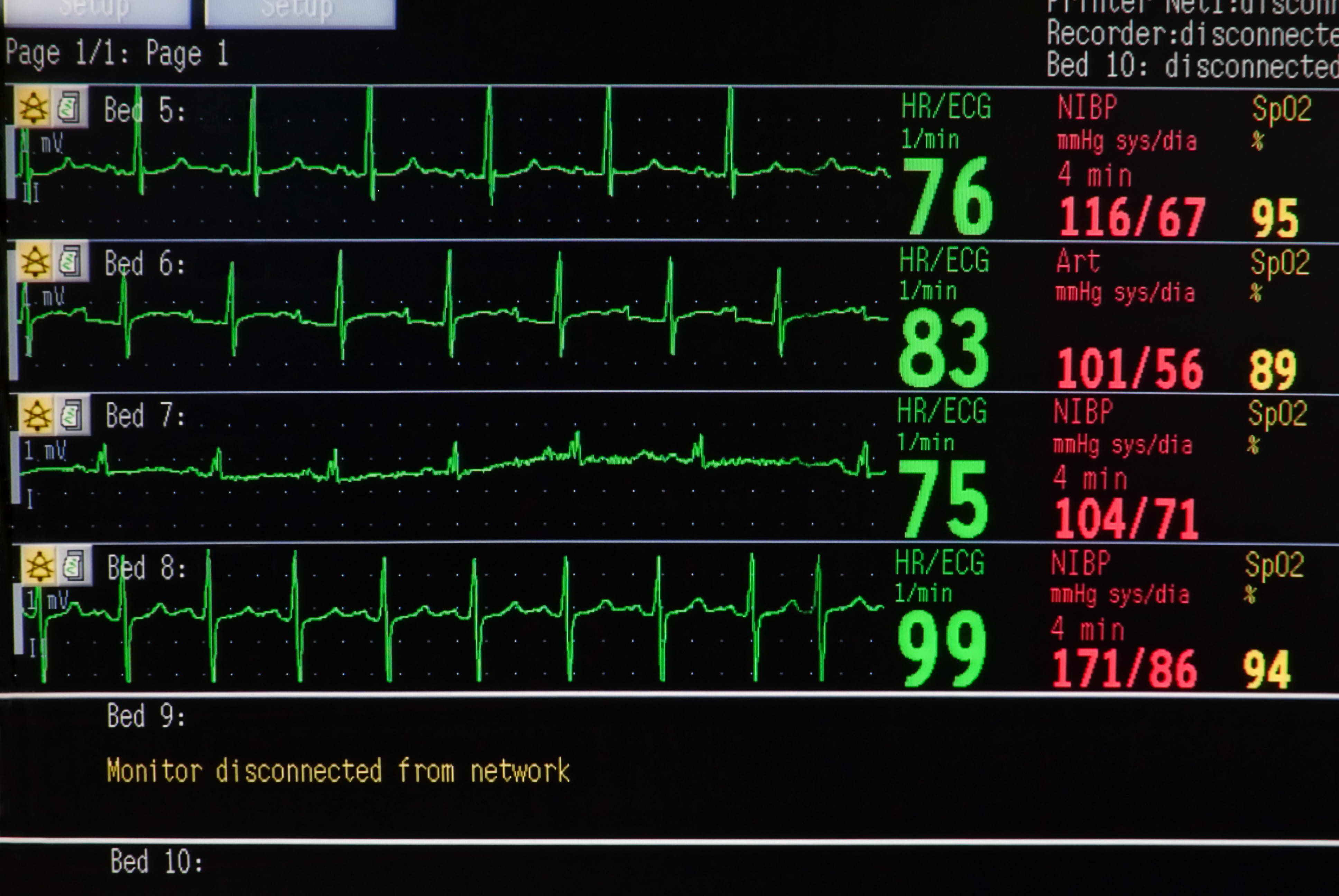 Cardiovascular monitor showing numbers
