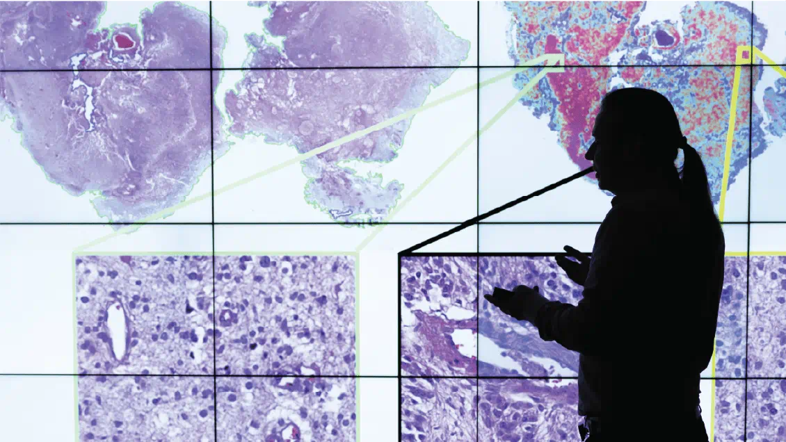 Spyridon Bakas is silhouetted by a digital screen taking up the full wall. The screen is displaying pathology slides used to augment the diagnostic capabilities of physicians with AI.