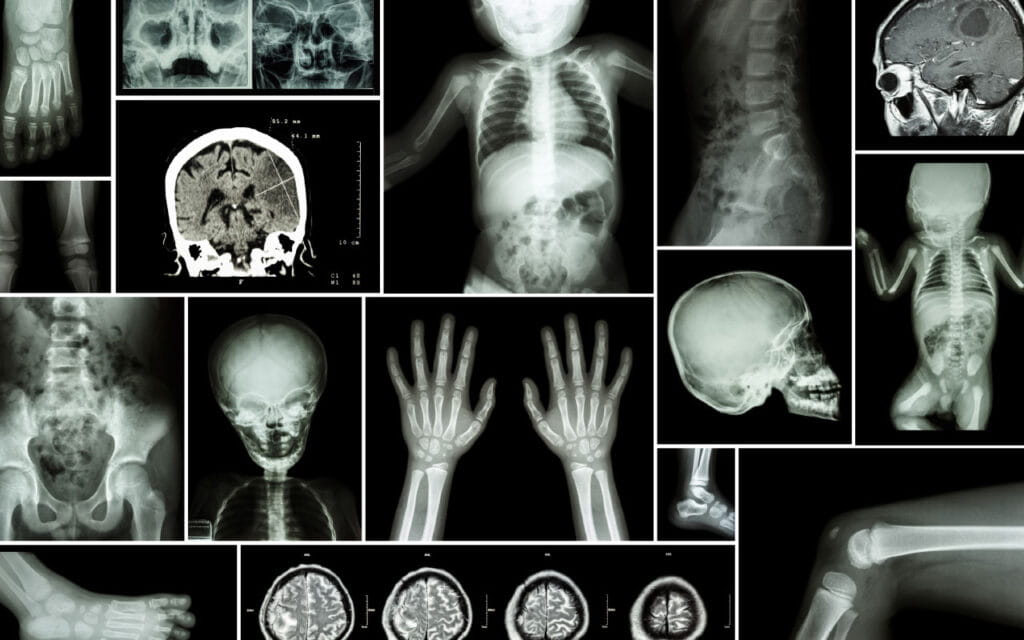 A collage of different types of pediatric scans.
