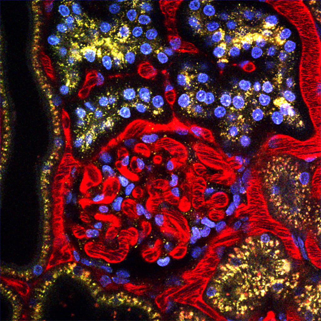 kidney-image2-inphoton-grant