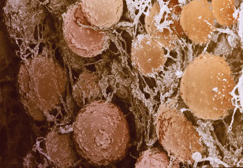 fat-cells-david-gregory-debbie-marshall