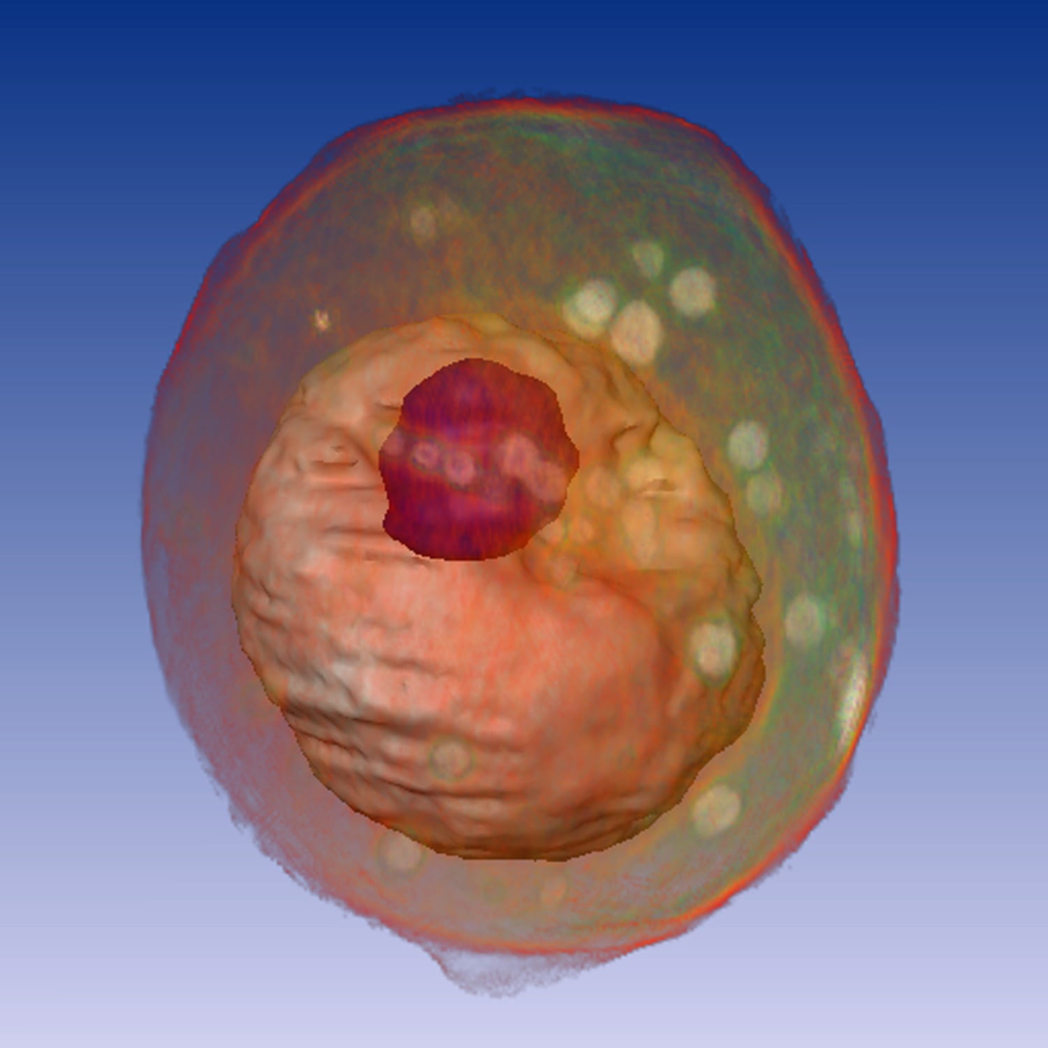 Yeast_cell_NIH