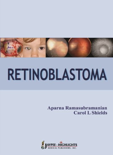 retinoblastoma2012