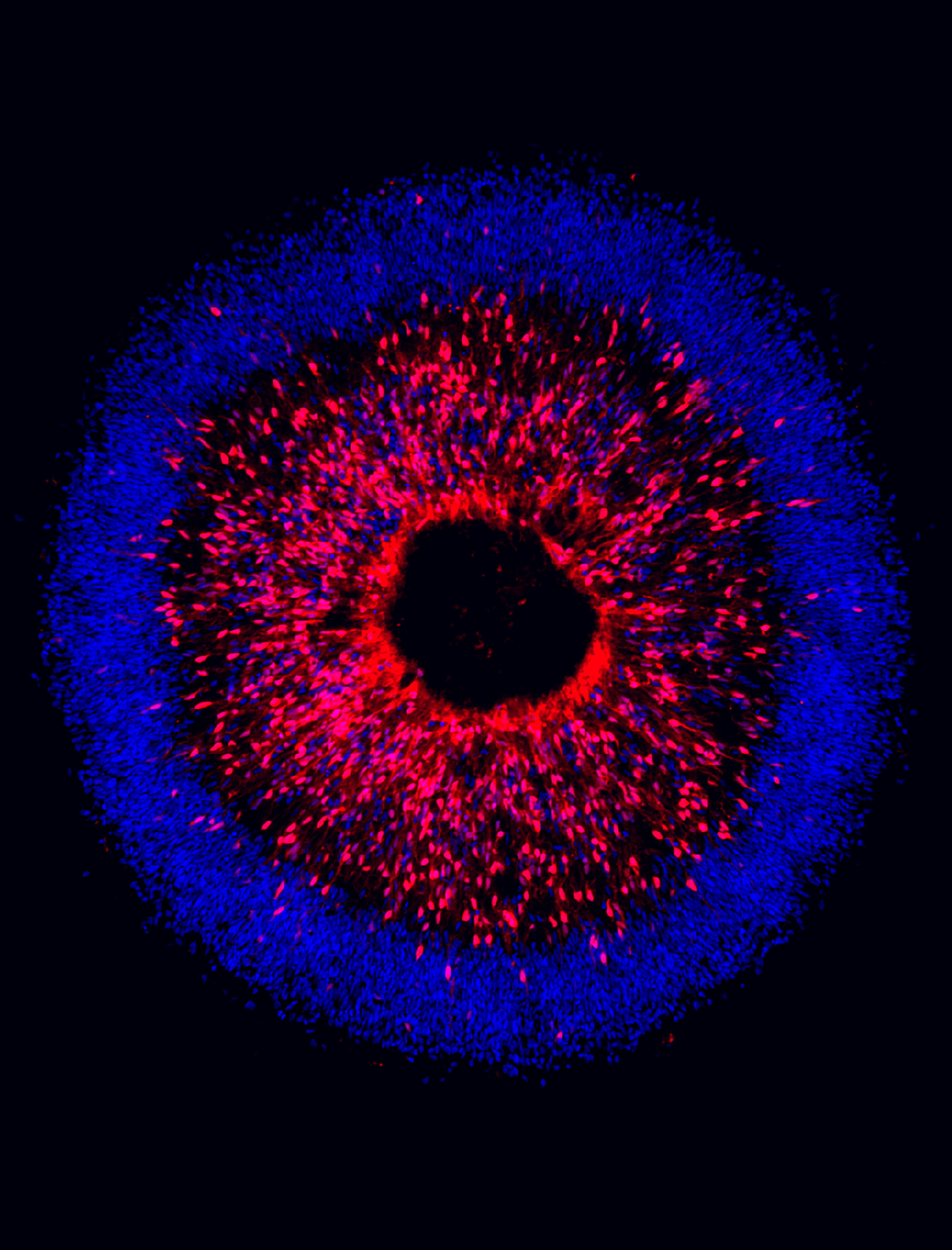 Stem cell glaucoma Stark Neuroscience