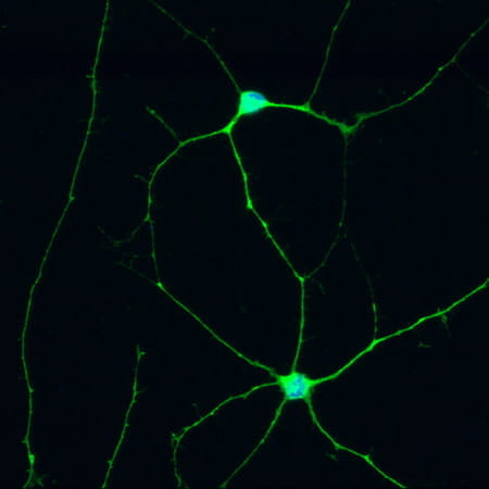 retinal ganglion cells