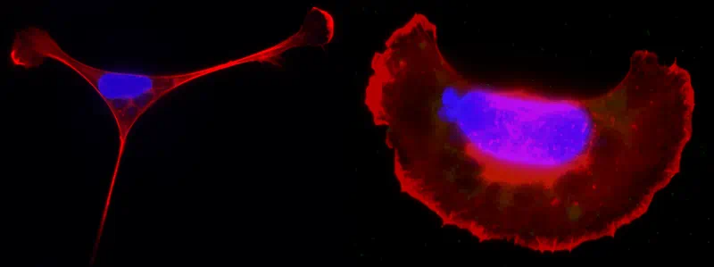 toxoplasma host cells
