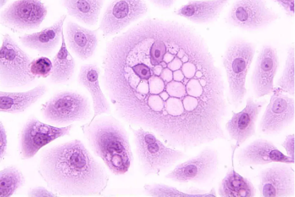 HPV