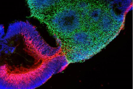 medical and molecular genetics retina