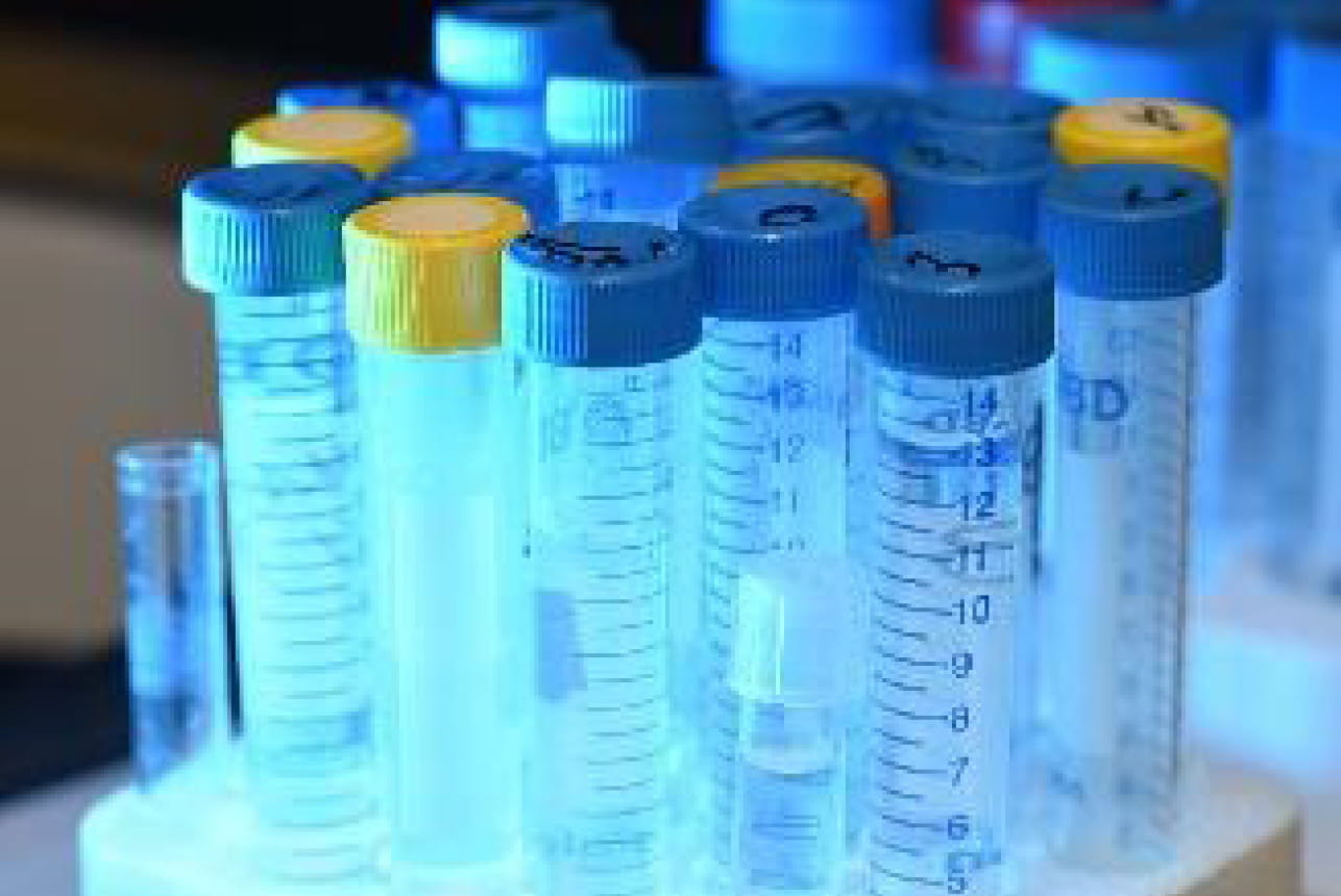 triple negative breast cancer