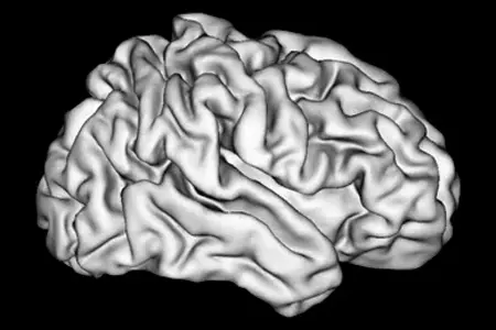 IU School of Medicine research shows how wrinkles in brain might ...