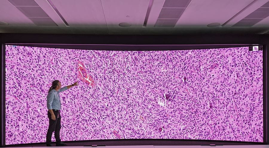 Spyridon Bakas, PhD looks at a tissue slide of a brain tumor on the Crystal Display Wall at the Cyberinfrastructure Building at Indiana University Bloomington. Spyridon Bakas, PhD looks at a tissue slide of a brain tumor on the Crystal Display Wall at the Cyberinfrastructure Building at Indiana University Bloomington.