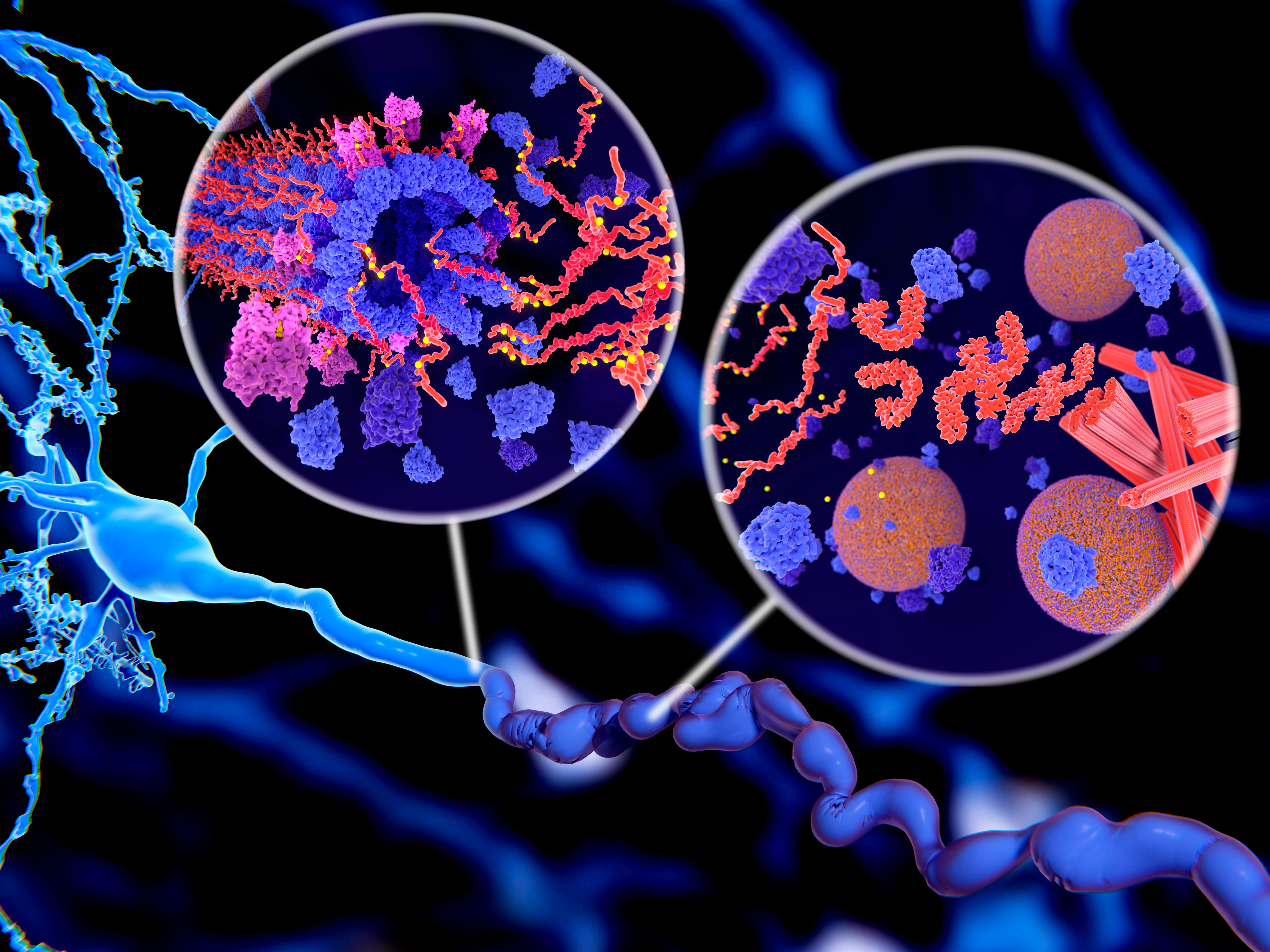 Tau protein in Alzheimer's disease, illustration. The insets show two ways in which pathological phosphorylation (yellow) of Tau proteins (red-orange) by kinases (blue-purple) affect nerve cells in what is called a neurofibrillary tangle. The main illustration showing a nerve cell (neuron, blue, lower left) and its axon (across bottom), shown in a misshapen and abnormal state. Pathological aggregations of tau proteins cause disintegration of microtubules (inset at left). The transport of synaptic vesicles (orange-blue spheres, inset at right) is also interrupted. A neurofibrillary tangle consists of abnormal aggregates and insoluble fibres of the protein tau. Tau protein is an abundant neural protein, aggregations of which are thought to play a role in Alzheimer's disease and other neural disorders.