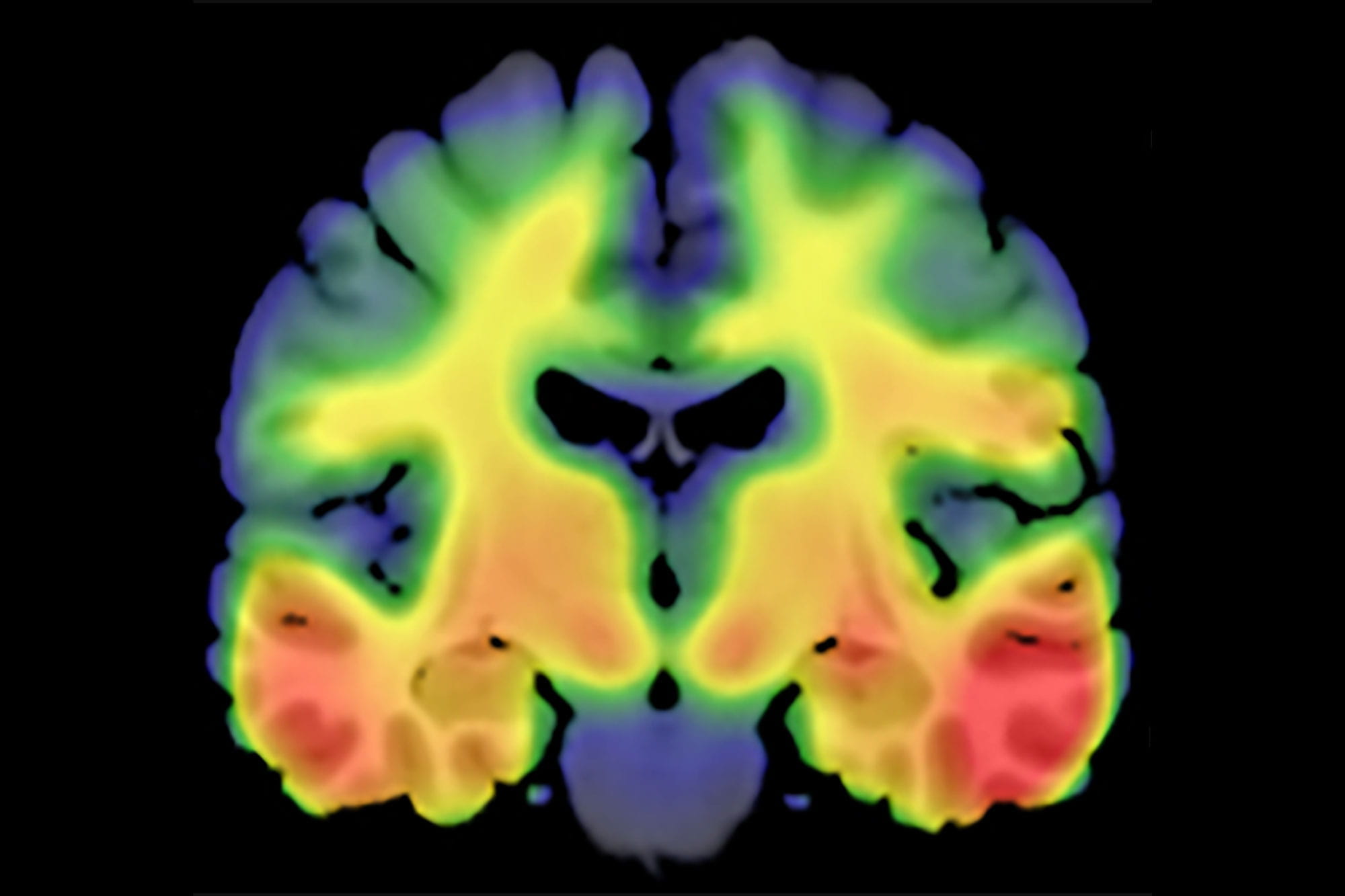 Image of a brain slice illuminated in rainbow colors