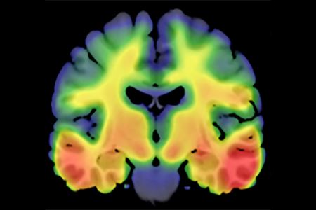 Image of a brain slice illuminated in rainbow colors