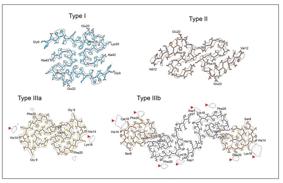 This figure shows a Cryo-EM map in transparent gray, with atomic model of a single molecule of type I and II Aβ42 filaments and type IIIa and IIIb Aβ40 filaments in Down syndrome. This figure shows a Cryo-EM map in transparent gray, with atomic model of a single molecule of type I and II Aβ42 filaments and type IIIa and IIIb Aβ40 filaments in Down syndrome.