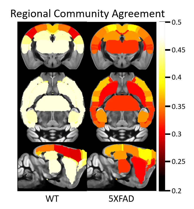 brain illustration