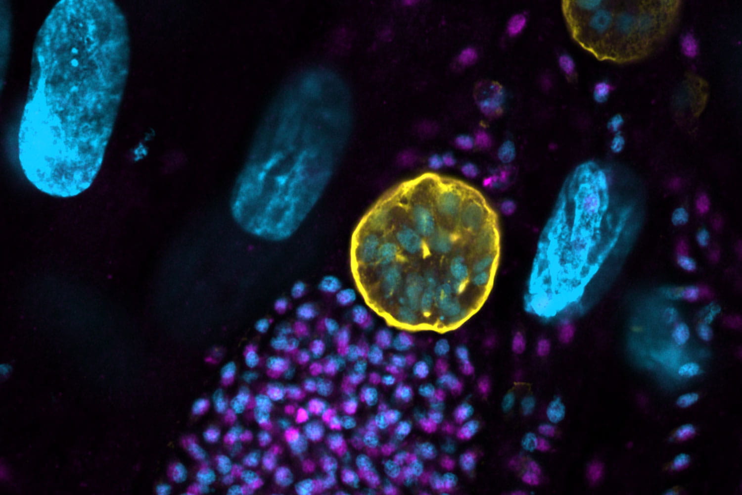 Microscopic image of Toxoplasma gondii