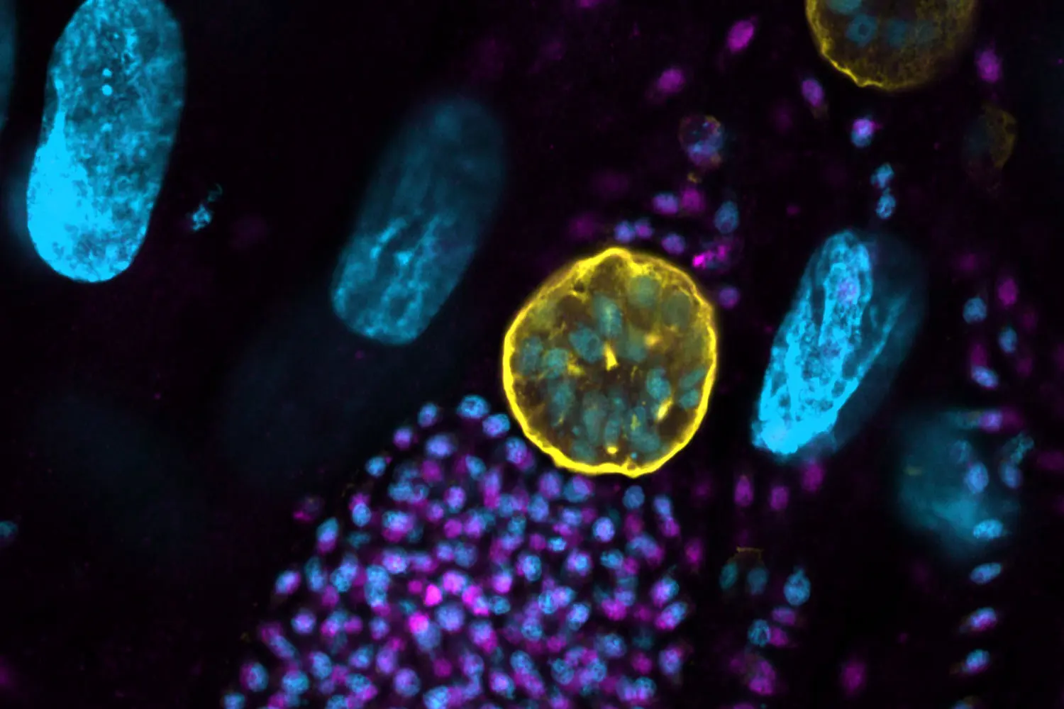 Microscopic image of Toxoplasma gondii