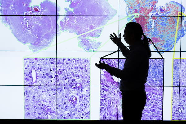 A man points to a large screen filled with brain scan slides. 
