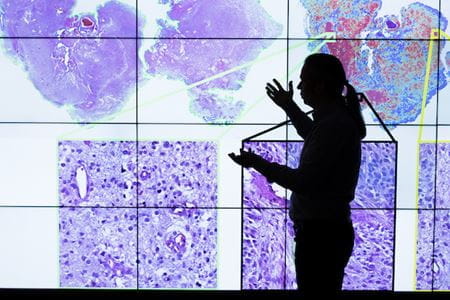 A man points to a large screen filled with brain scan slides.