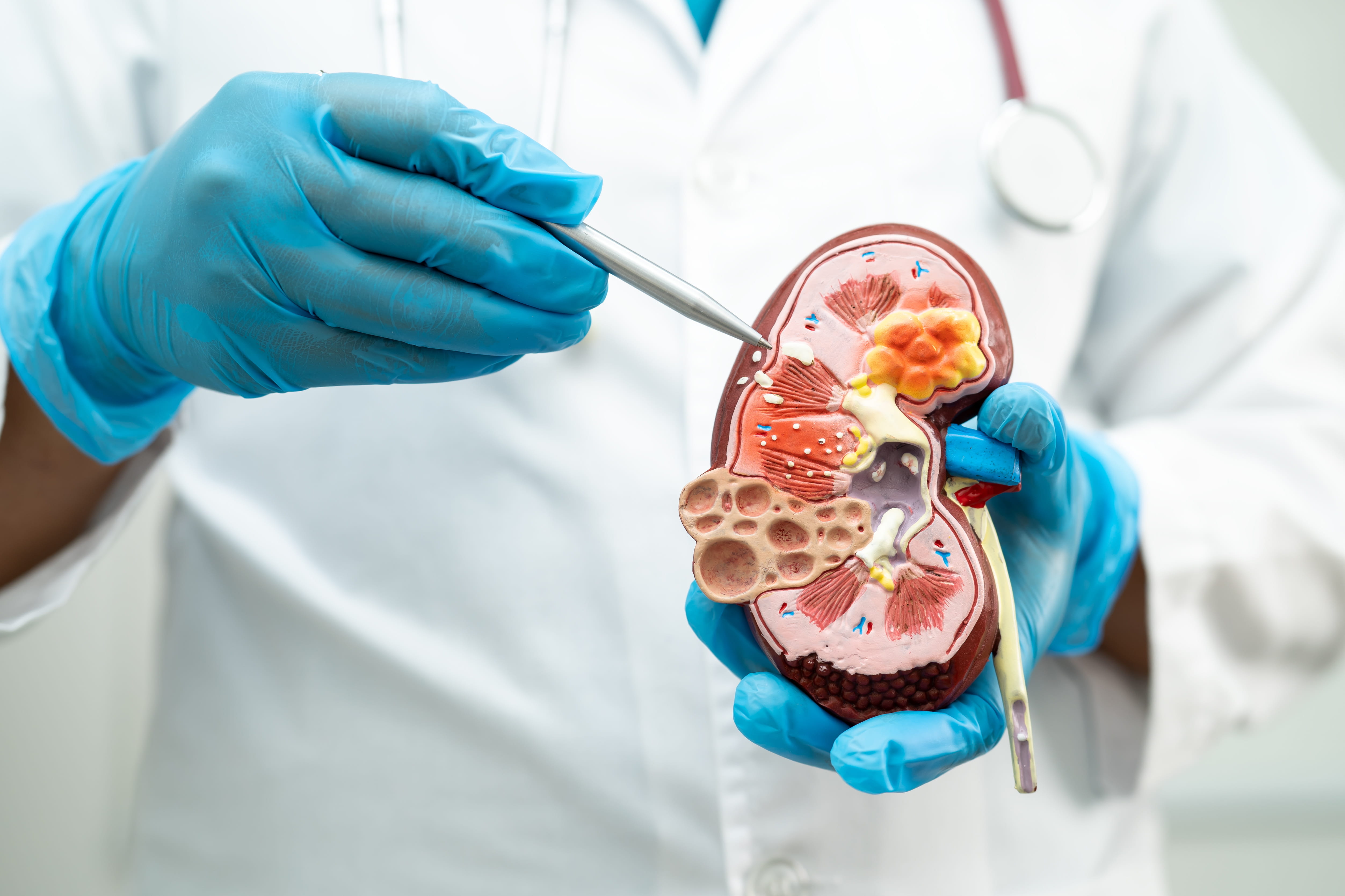 A stock image of someone holding a model kidney