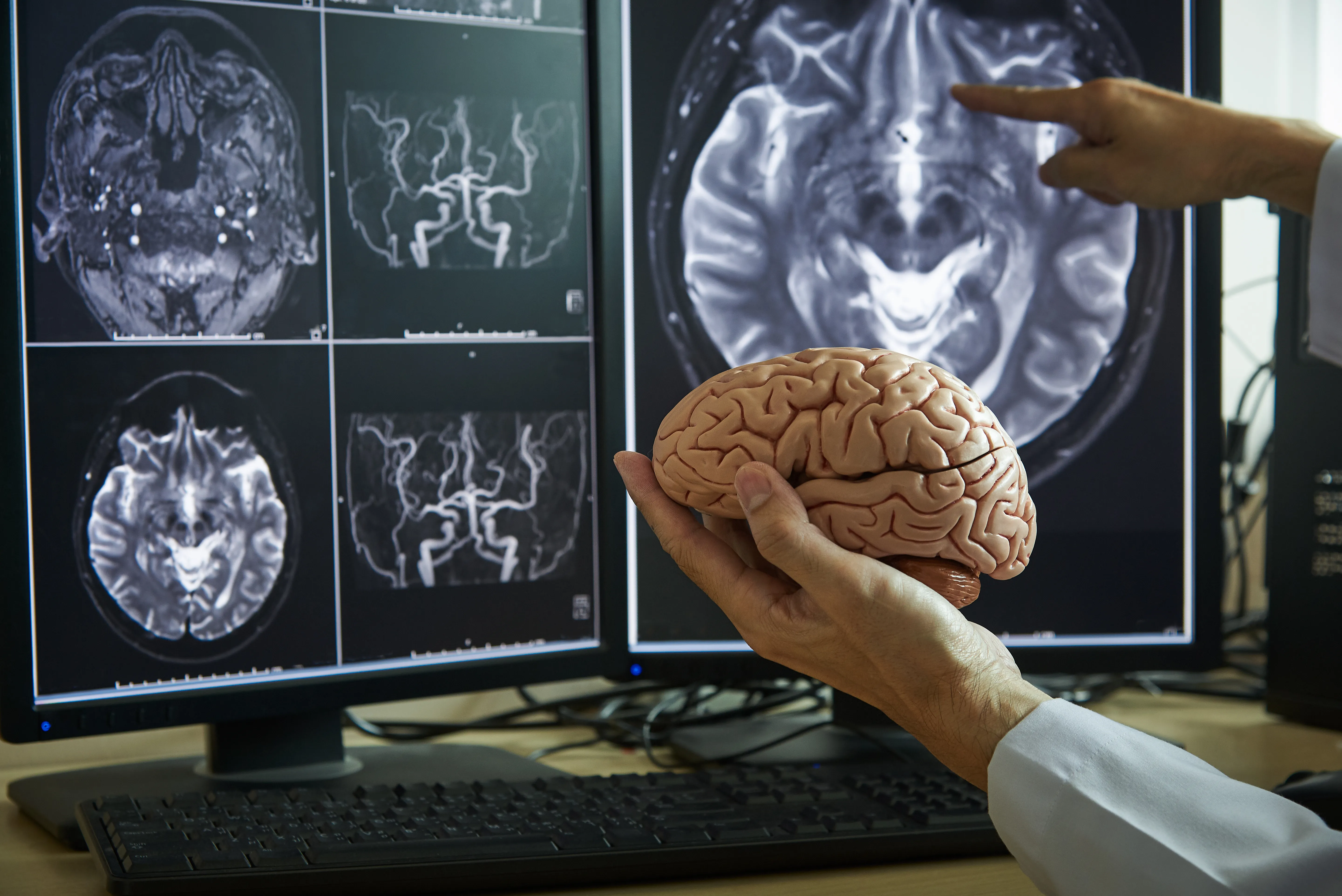 A stock photo of brain scans and a brain model. 