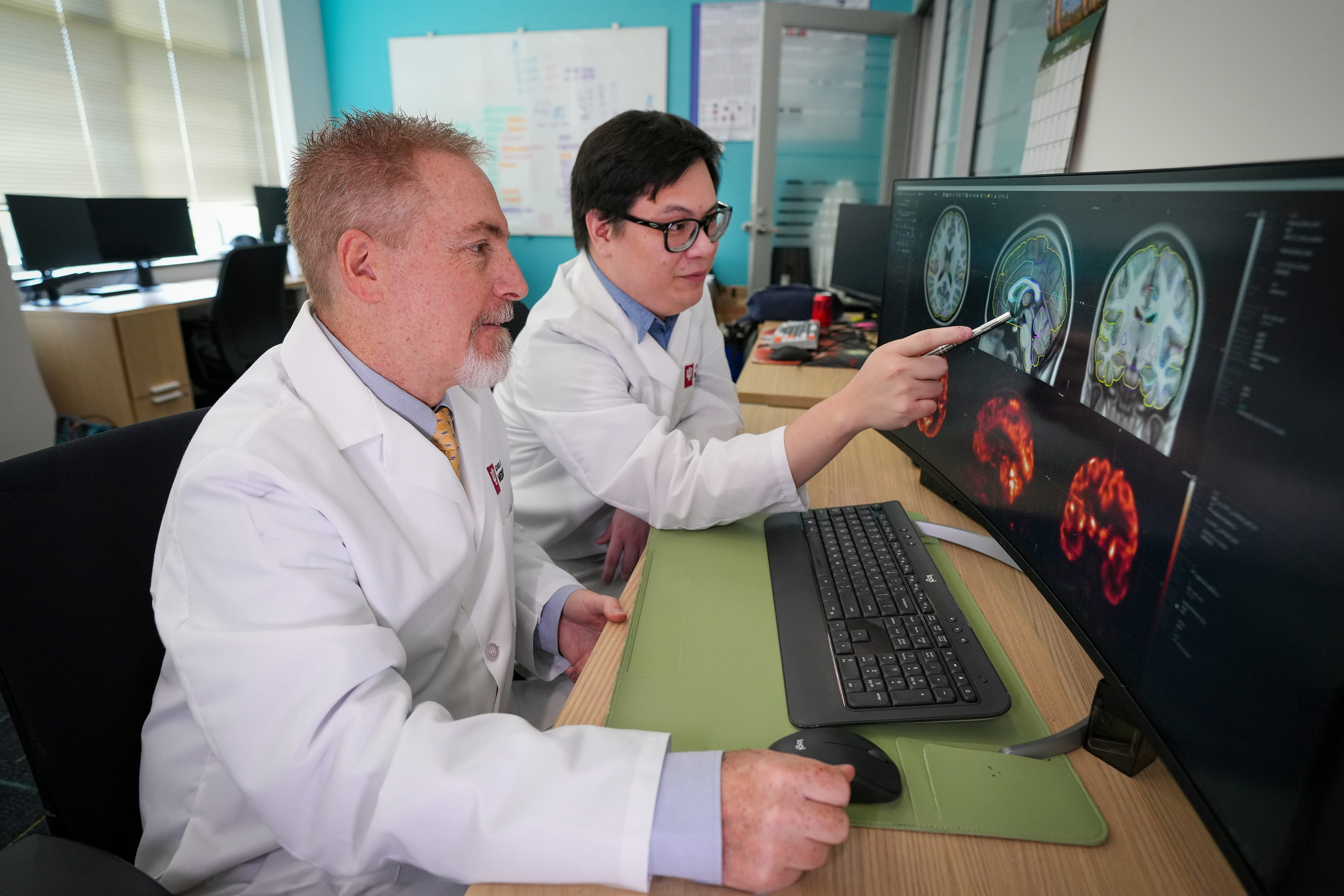 Researchers view brain scans