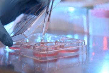 Bone Healing and Regeneration Research