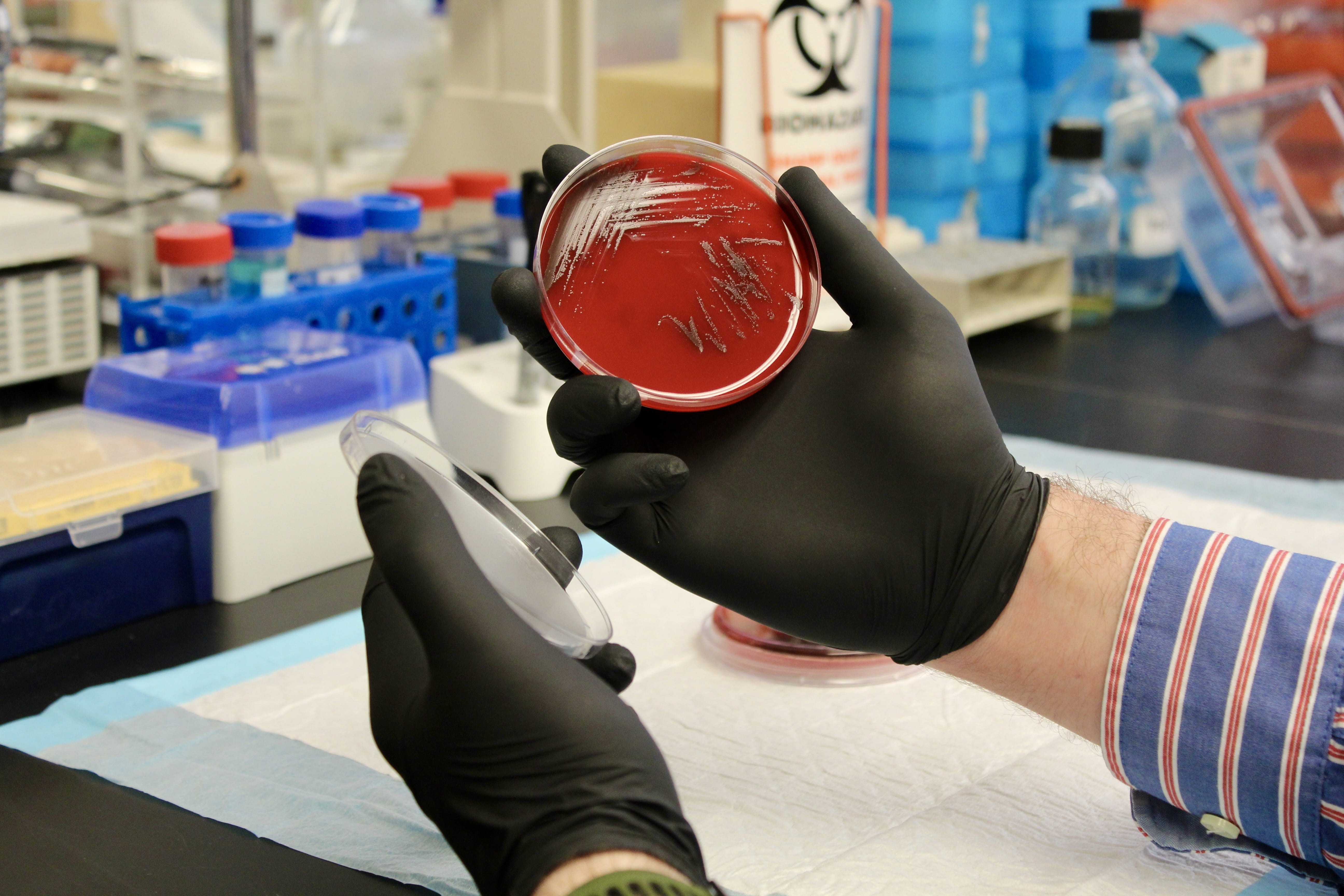 Petri dish sample being held and analyzed