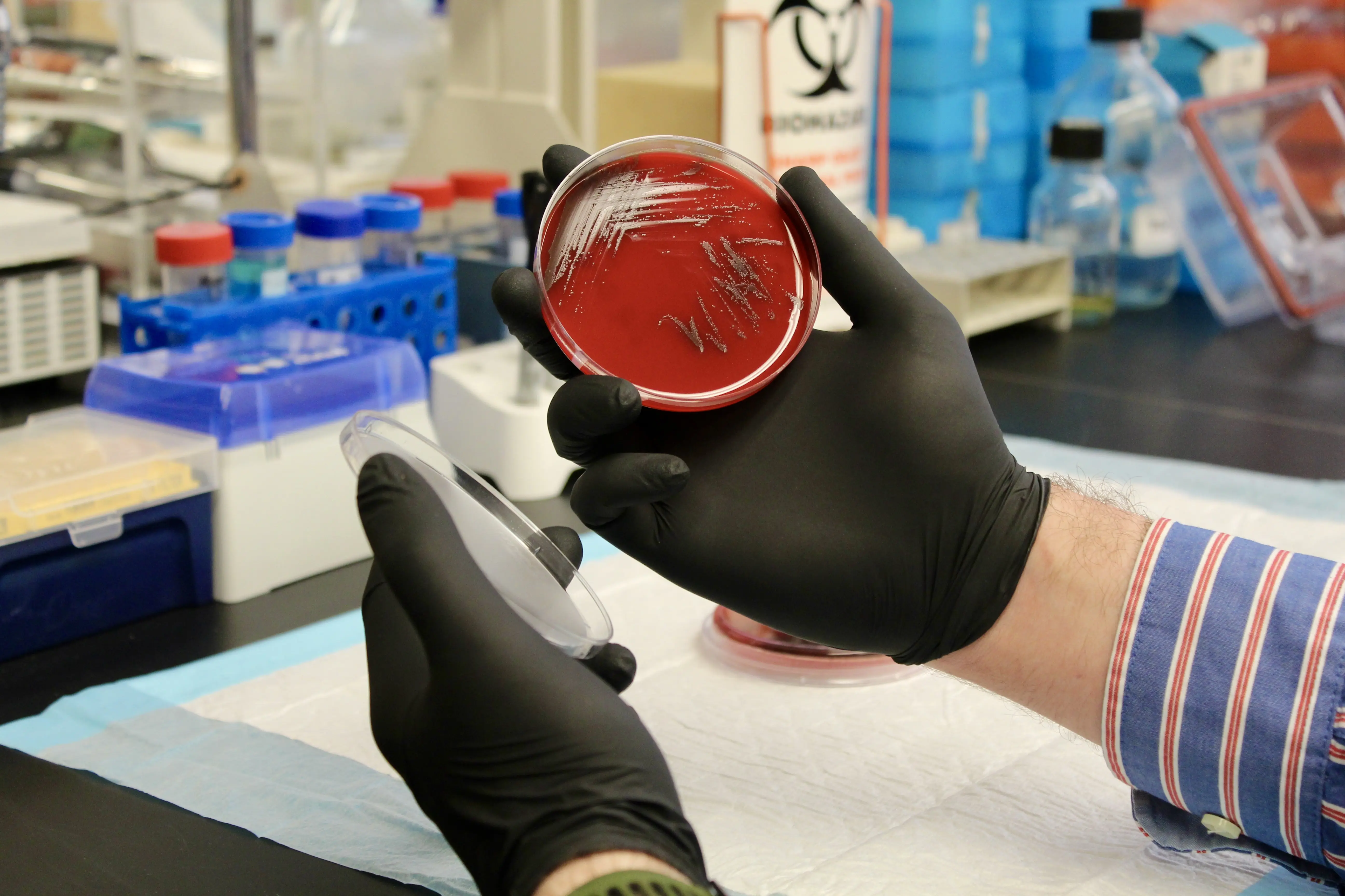 Petri dish sample being held and analyzed