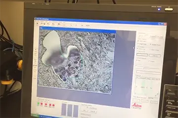Pediatrics Computing displaying a lab result