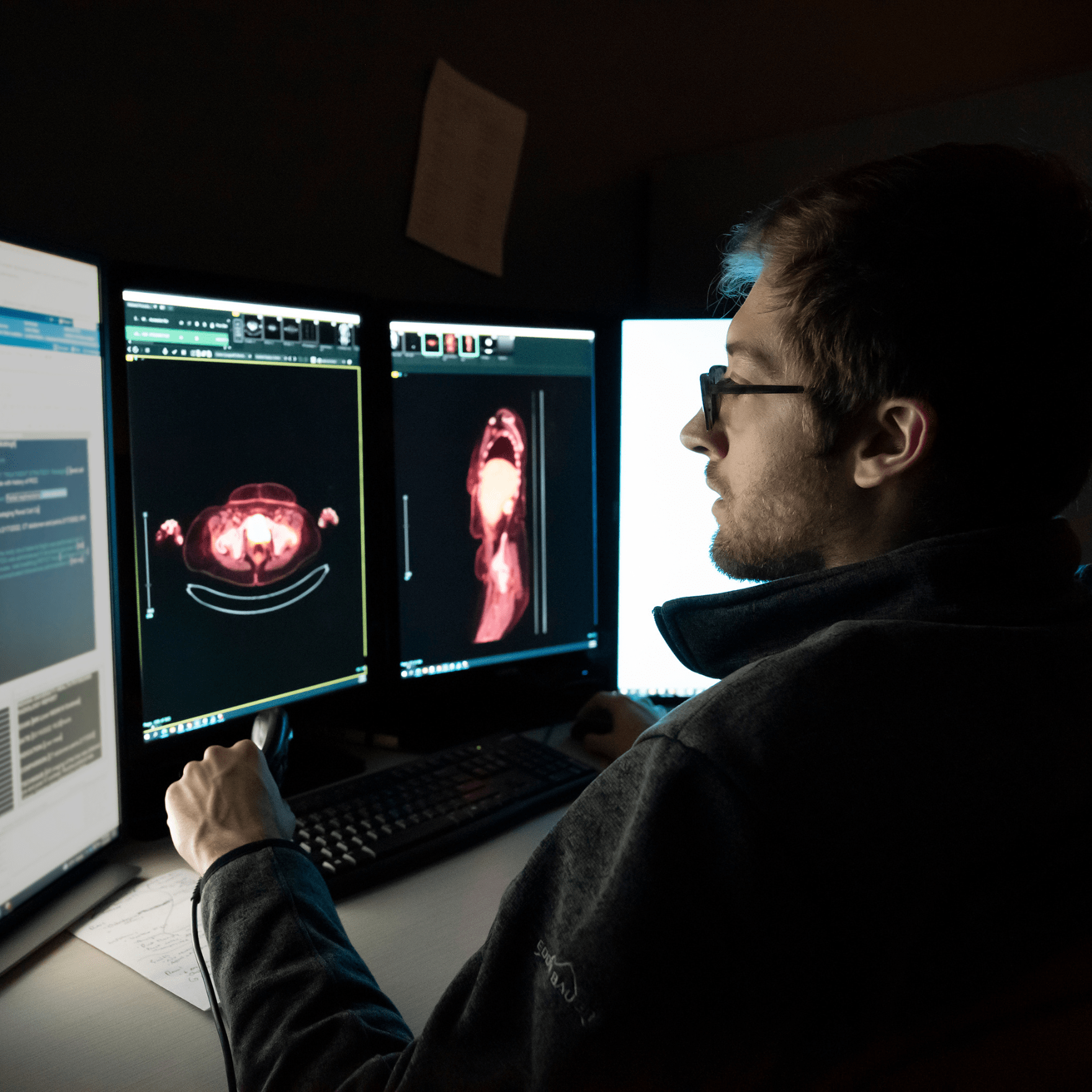 A male radiologist studies an abdominal scan.
