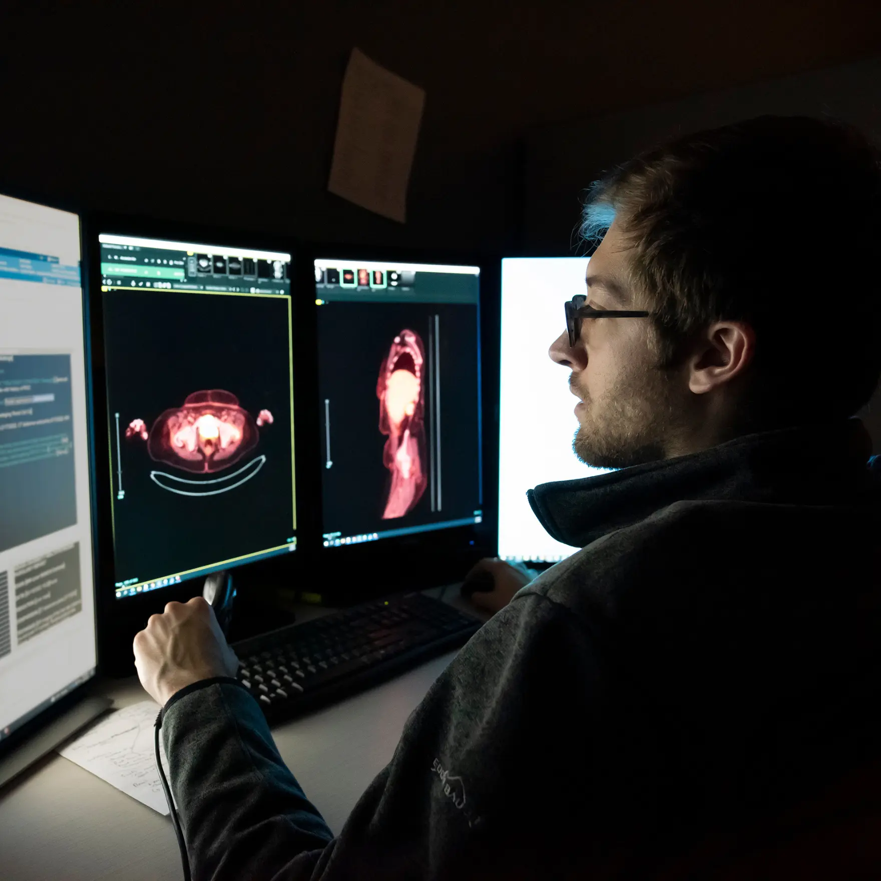 A male radiologist studies an abdominal scan.