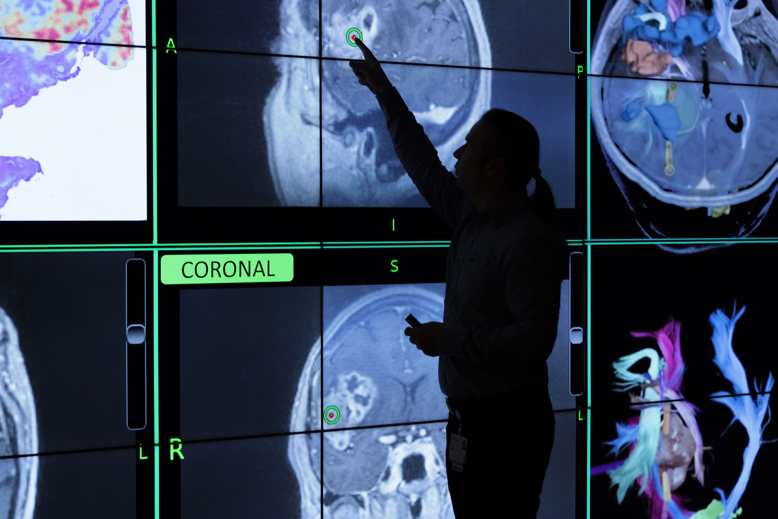 A man points at a large screen filled with brain scans. 